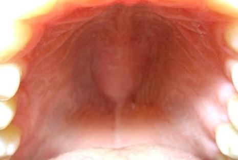строение и функции слизистой оболочки полости рта 