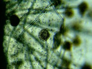 Микробы под микроскопом