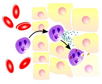 Reduced neutrophils in a child