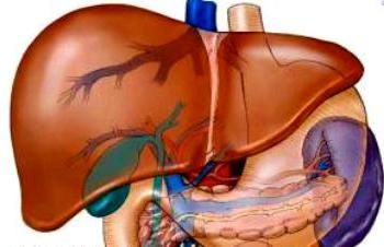 Moderate hepatomegaly