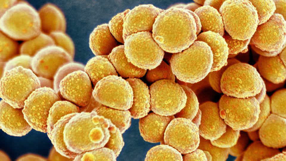 Staphylococcus aureus 4. Стафилококк ауреус золотистый. Метициллин-резистентный золотистый стафилококк. Стафилококк золотистый Staphylococcus aureus. S. aureus золотистый стафилококк.