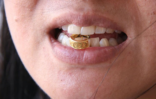Метод пробы золота на зуб