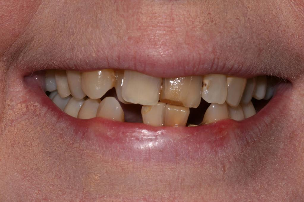 Кривые больные зубы