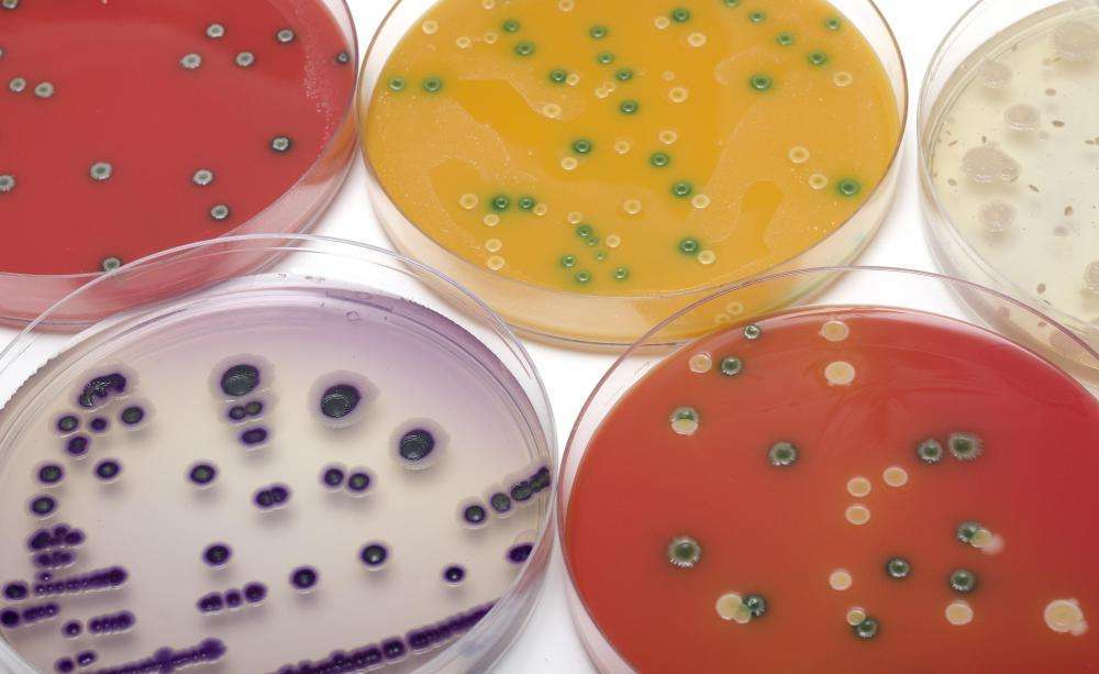 анаэробные бактерии