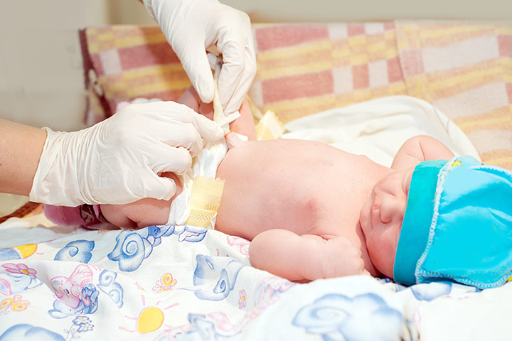 Caring for a newborn's navel