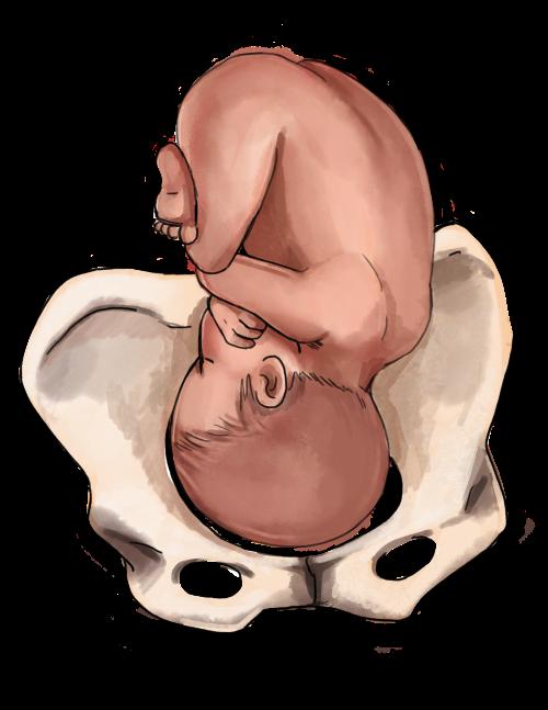 Самопроизвольные роды до 34 недель. Головное предлежание плода. Продольное головное предлежание плода 34 недели. Ребенок в утробе головой вниз.