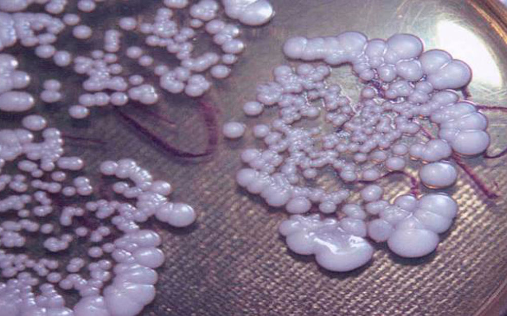 Какой должен быть цвет половых. Candida parapsilosis микроскопия. Кандидозный кольпит фото. Урогенитальный кандидоз.
