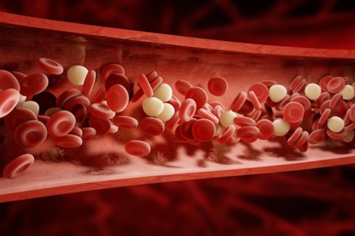 диагностика лечение тромбоэмболии легочной артерии