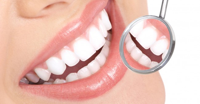 Процедуры по отбеливанию зубов 