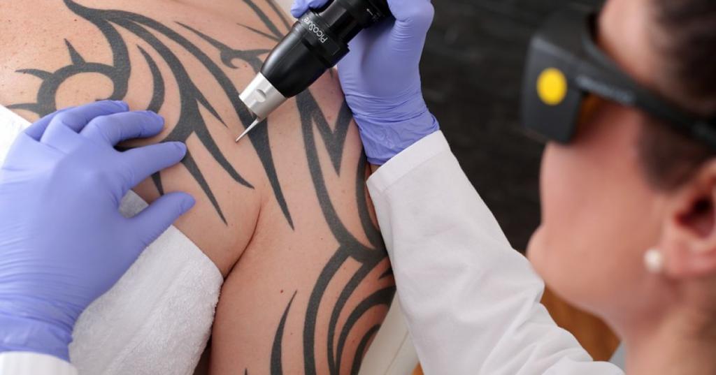 Нанесение татуировки