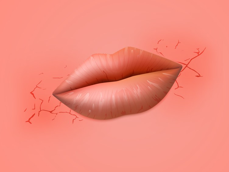 Рисунок пораженных губ
