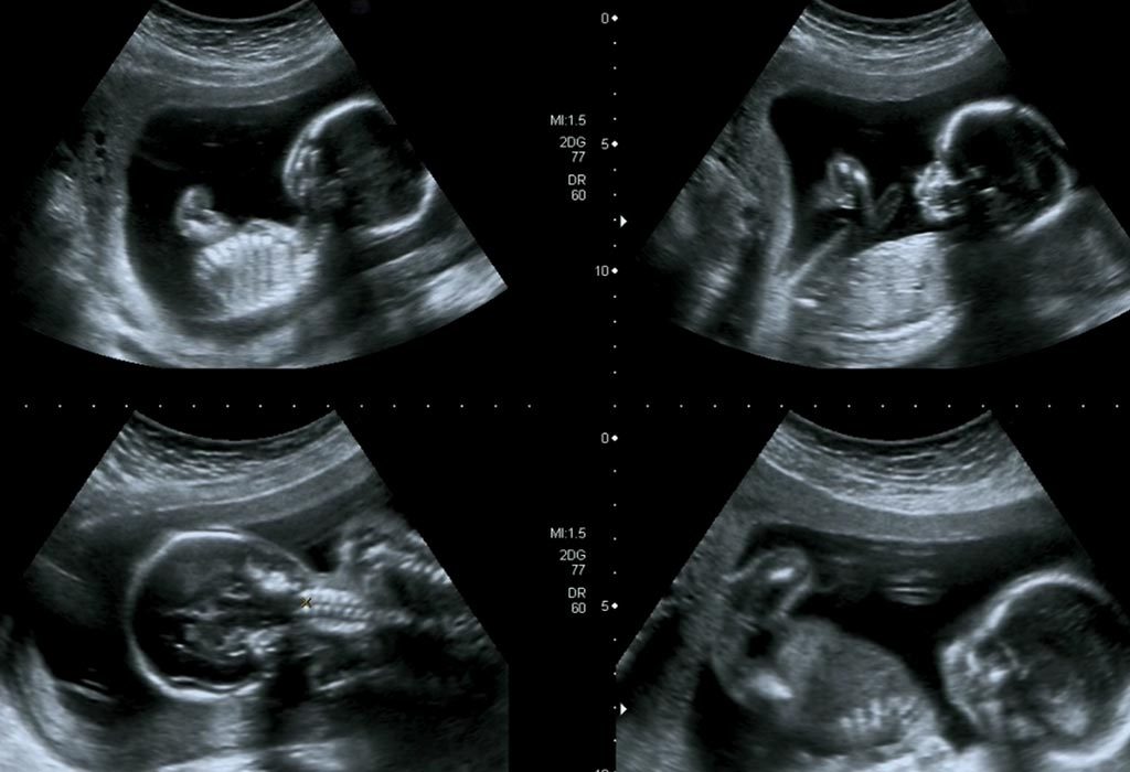 Матка во время беременности фото 100