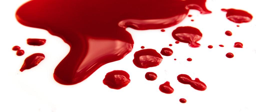Причины возникновения кровотечения