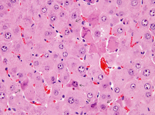 ранний апоптоз в клетках гепатоцитов