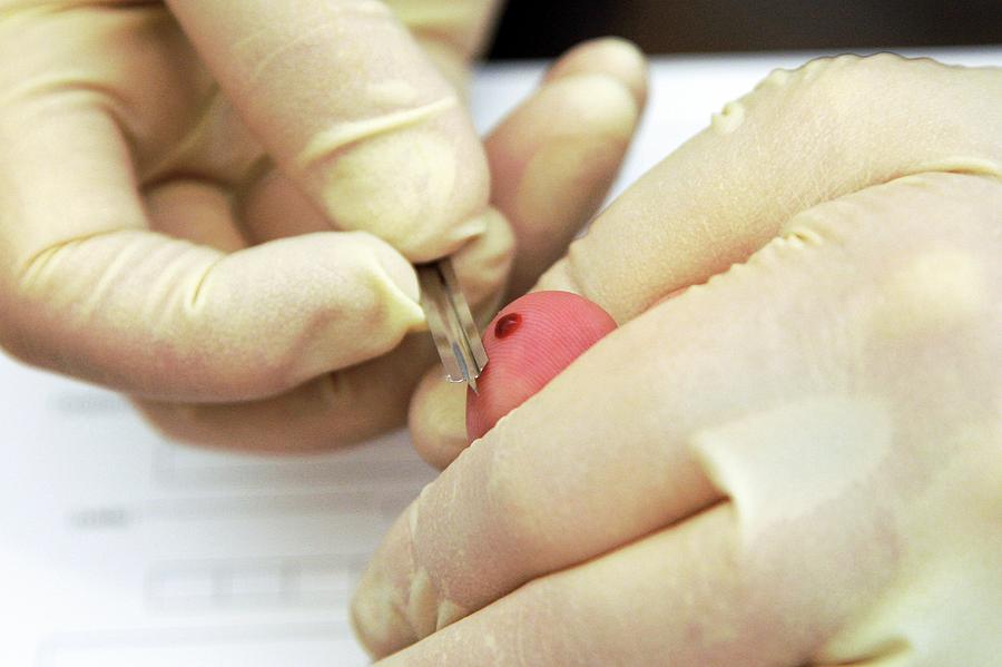 Анализ крови из пальца можно ли есть