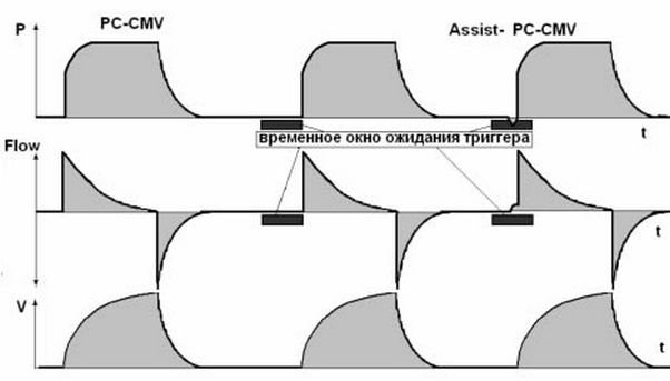 принудительная вентиляция с контролем по давлению