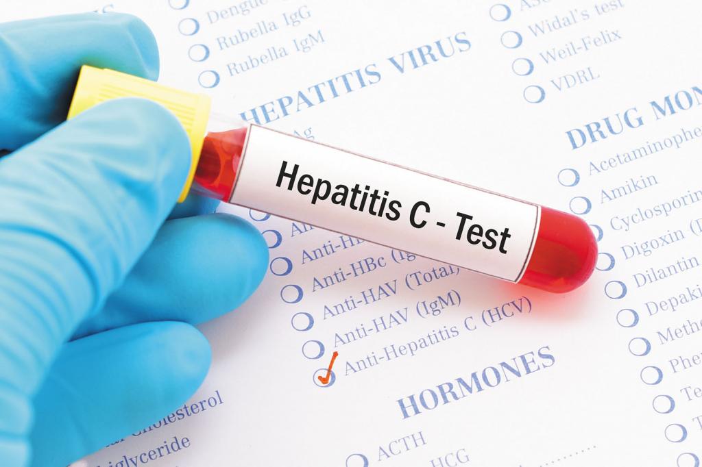 Тест на гепатит C