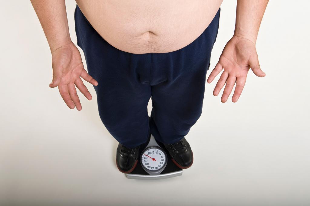 obesity due to thyroid disease