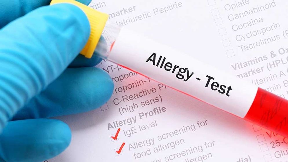 методы диагностики аллергии