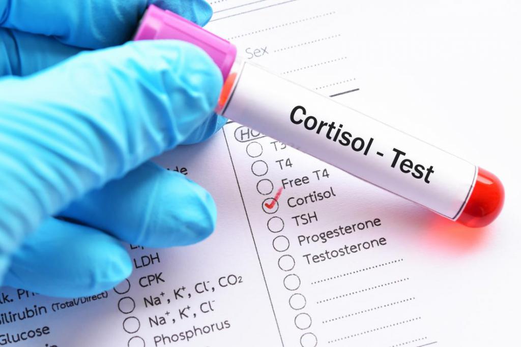 how to check cortisol
