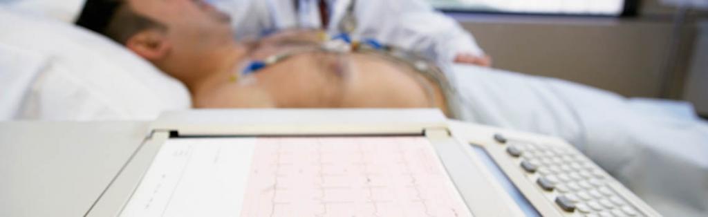 ЭКГ диагностика острого инфаркта