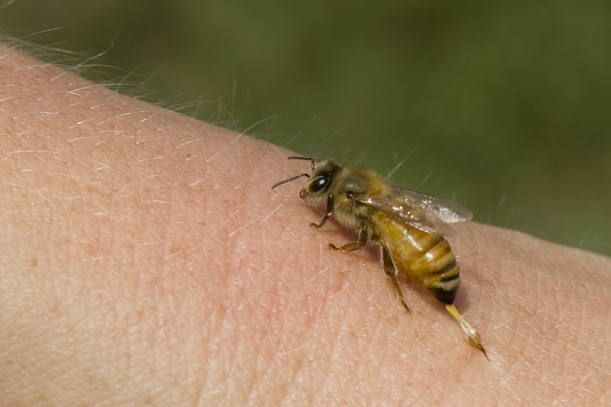 Что делать при укусах насекомых