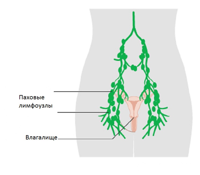 The scheme of the inguinal lymph nodes