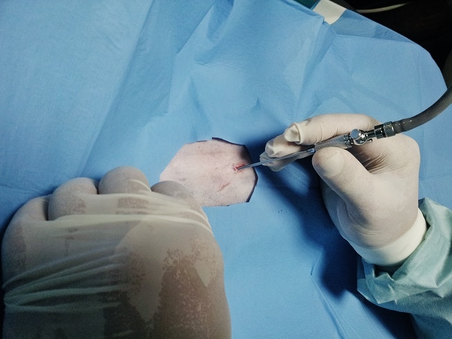 Laparoscope Introduction