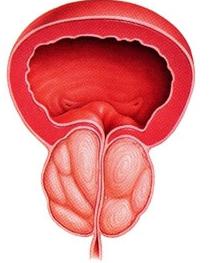 лечение рака простаты народными средствами