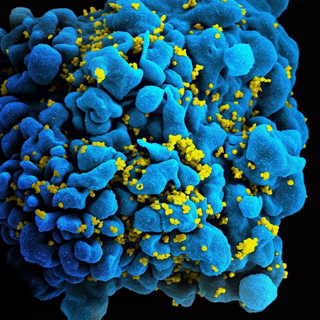 Лимфоциты (желтые) атакуют клетки вируса