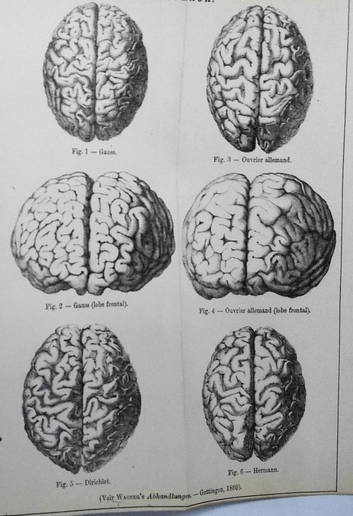 Виды человеческого мозга