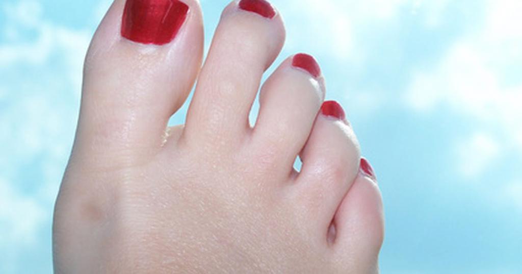 Коричневые пятна на ногтях больших пальцев ног 26
