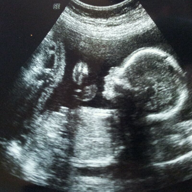 19 недель беременности фото плода в животе