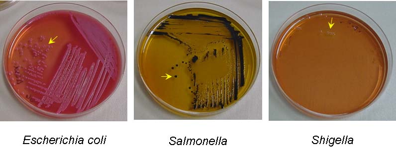 бактериологический анализ кала на дисбактериоз