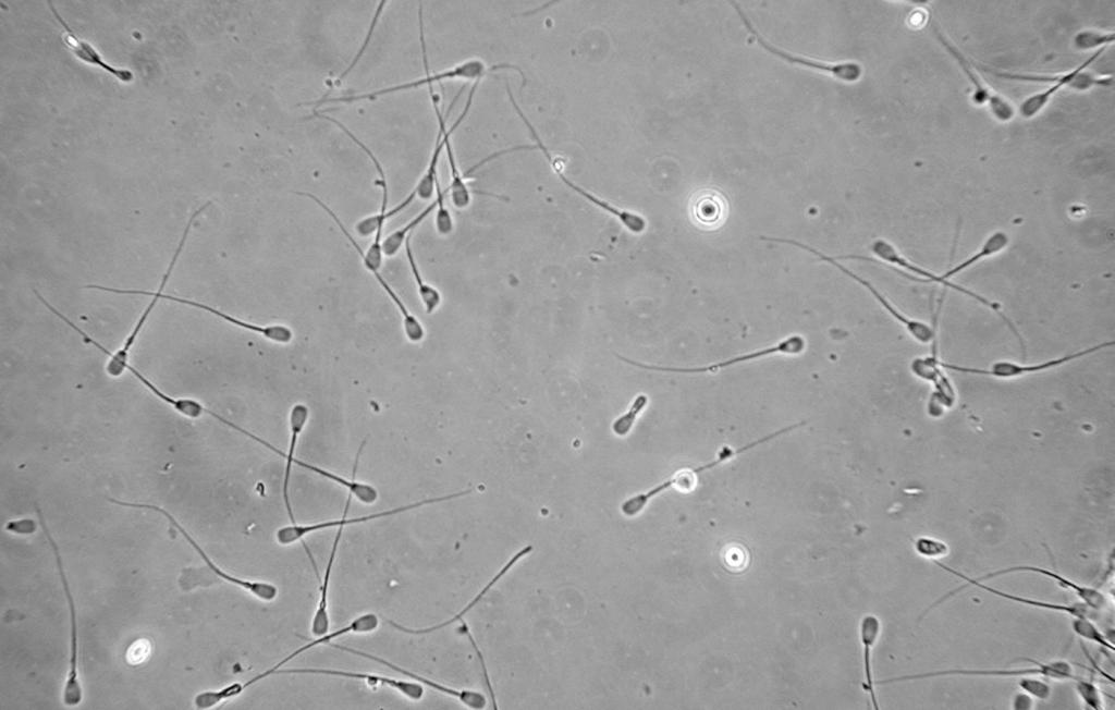 Половая жидкость. Микроскопия семенной жидкости. Сперматозоиды в моче под микроскопом. Сперматозоид под микроскопом. Спермограмма микроскопия.