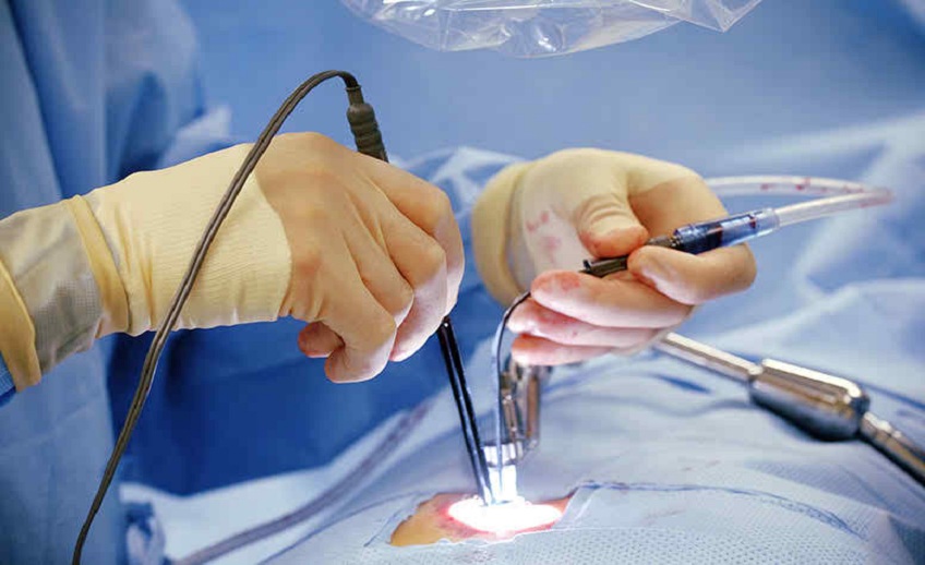 Endoscopic surgery