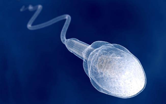 Причины патологии сперматозоида