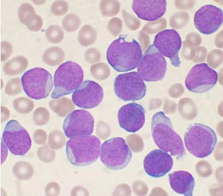 Роль лимфоцитов в организме
