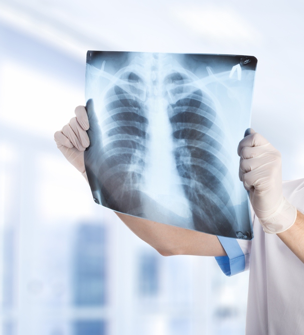 Рентген или МРТ позвоночника