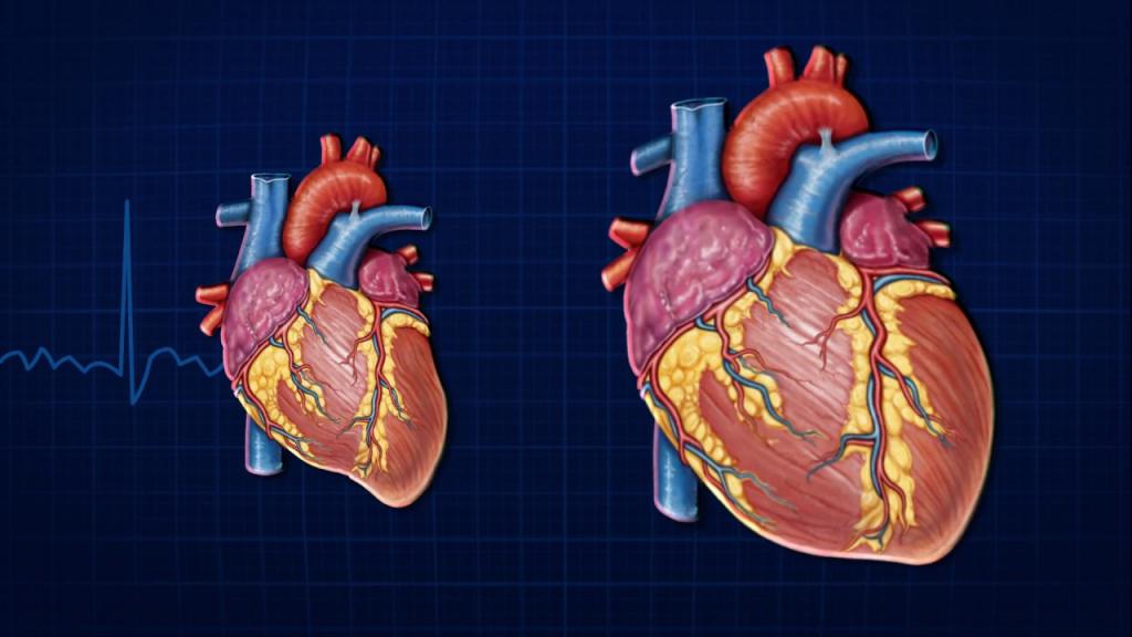 Сердце и аорты