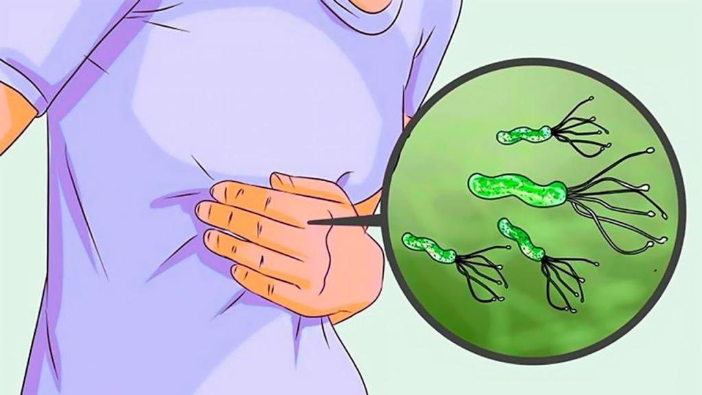 symptoms and treatment of helicobacter pylori