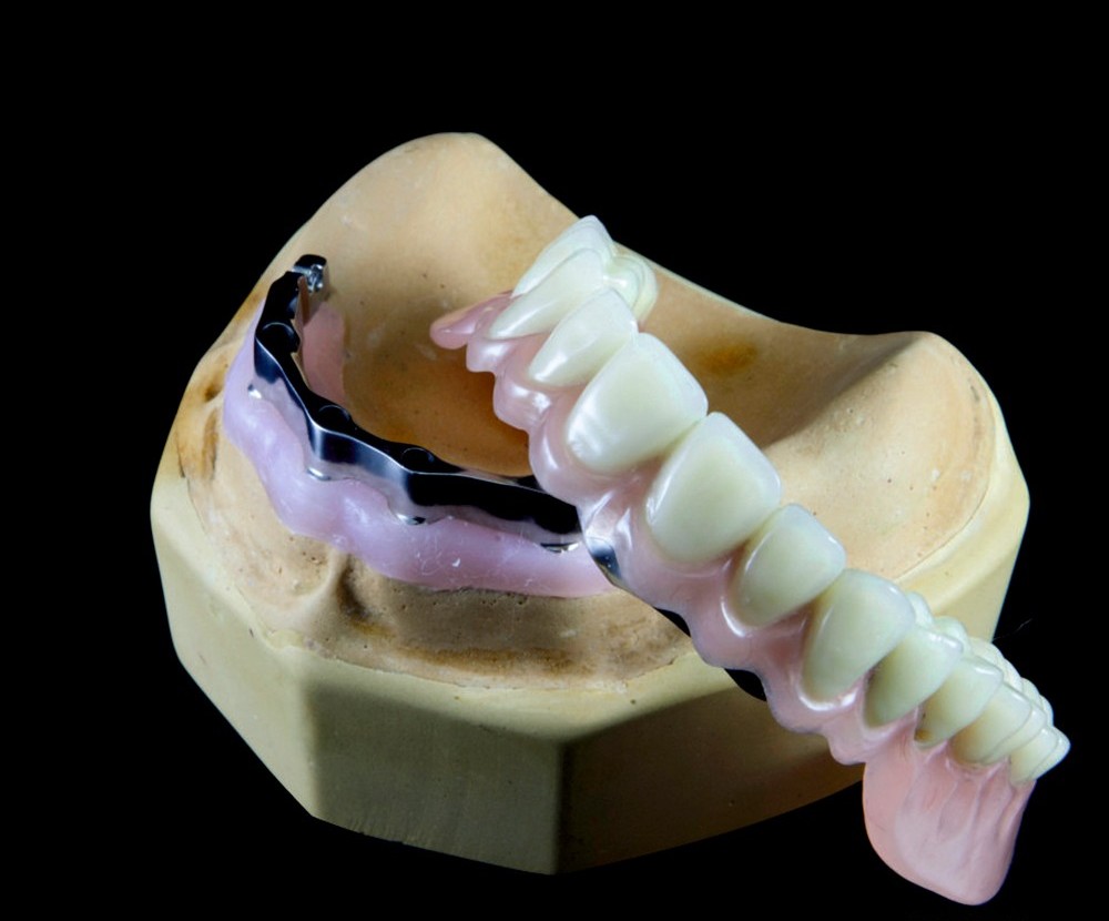 Clasps with dentures