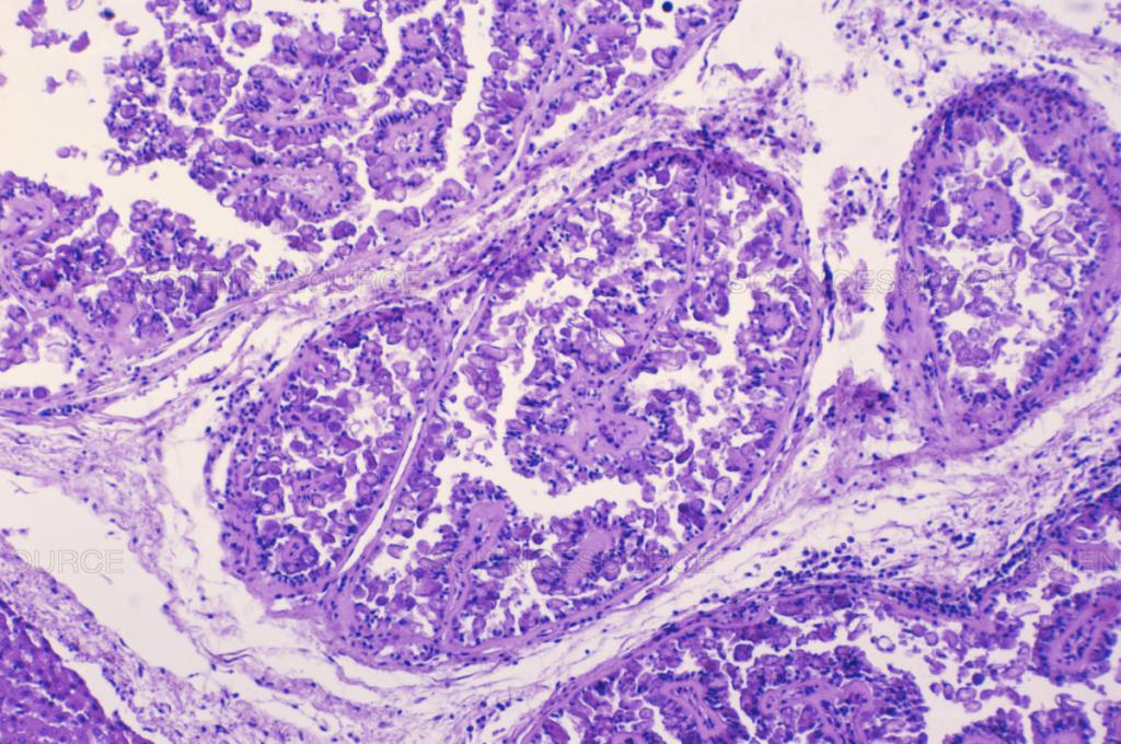 Histology of Eimeriosis