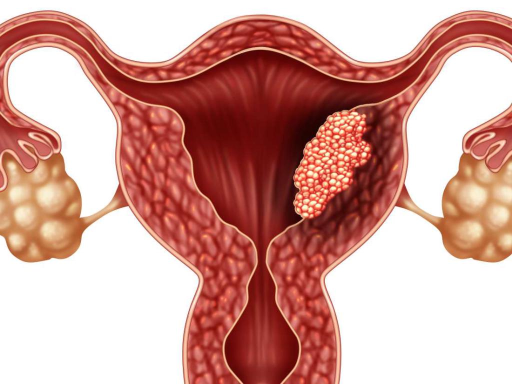 Uterus of the woman
