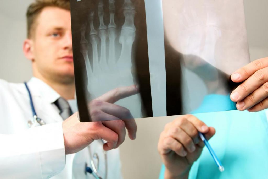 Рентген голеностопа: показания к обследованию, что показывает, норма и отклонения