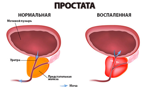 Проявление патологии