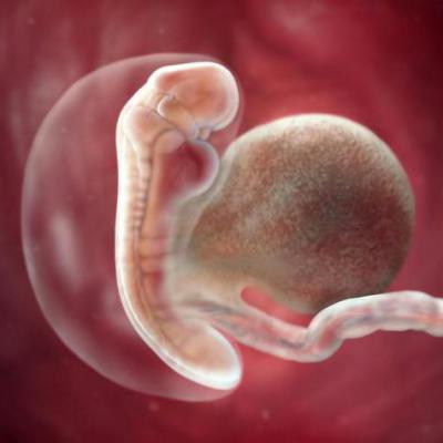 Фото Эмбриона 5 Недель Беременности Узи