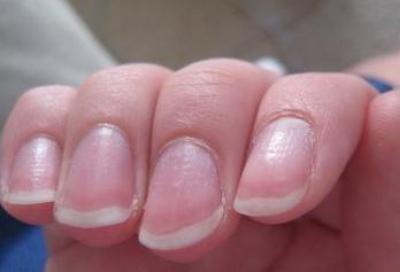 Белый полукруг на ногтях. Ногти полукруг. Полукруг на ногтевой пластине. Ногтевая пластина полукруглая.