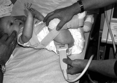 Изображение - Ультразвуковое исследование тазобедренных суставов у новорожденных норма 1429628