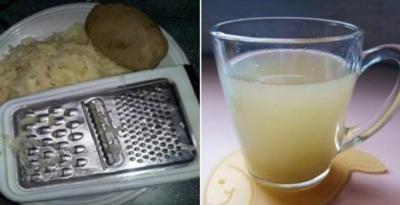 картофельный сок при панкреатите и холецистите в домашних условиях